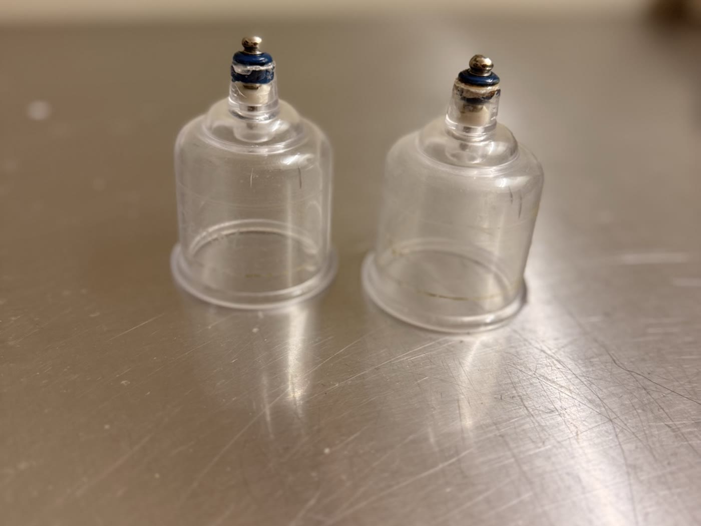 Glass cupping sets used in treatment, laid out on a stainless steel tray